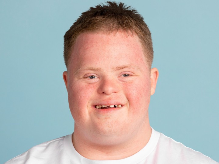 Young down syndrome man, smiling face portrait